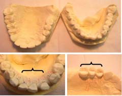 ���o�͌^�@�ʐ^