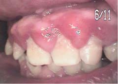 ���o���@�ʐ^