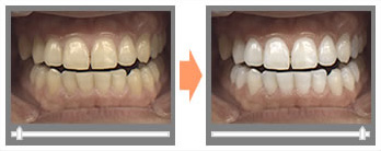施工前施工後イメージ